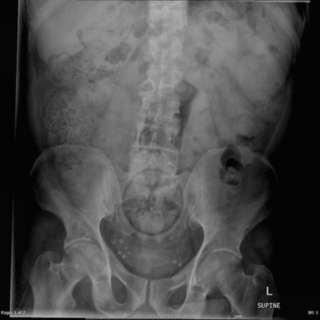 Website Compiles X Ray Photos Of Weird Things Stuck Up People S Butts