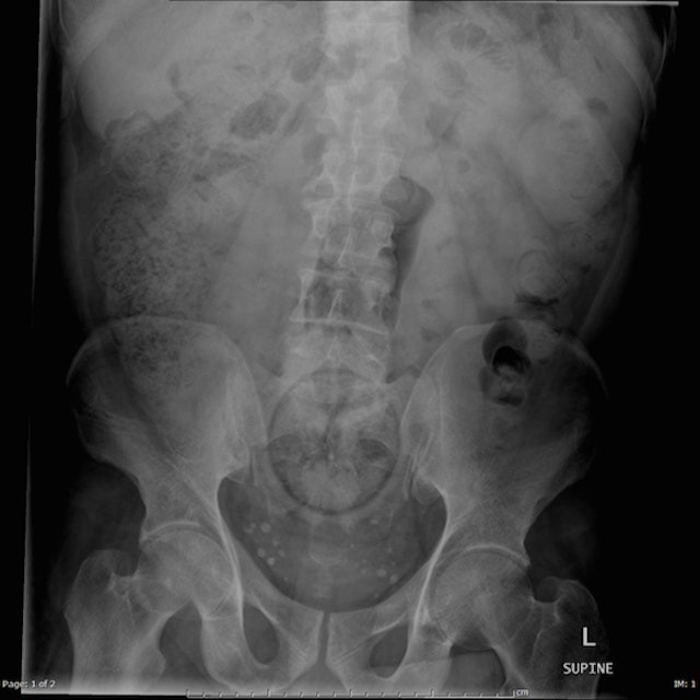 Website Compiles X Ray Photos Of Weird Things Stuck Up Peoples Butts