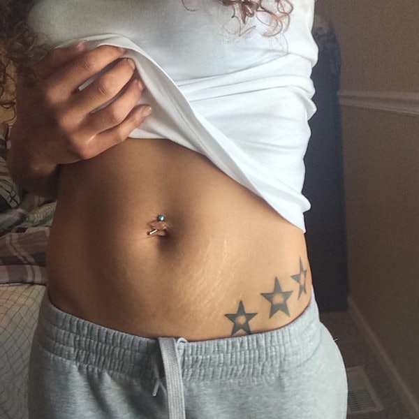 Elite Auto Credit >> Women Proudly Share Pictures Of Their Stretch Marks With #LoveYourLines Elite Auto Credit >> Women Proudly Share Pictures Of Their Stretch Marks With #LoveYourLines