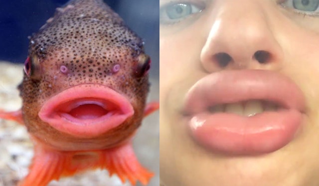 12 Fish That Look Just Like Girls Who Did The Kylie Jenner