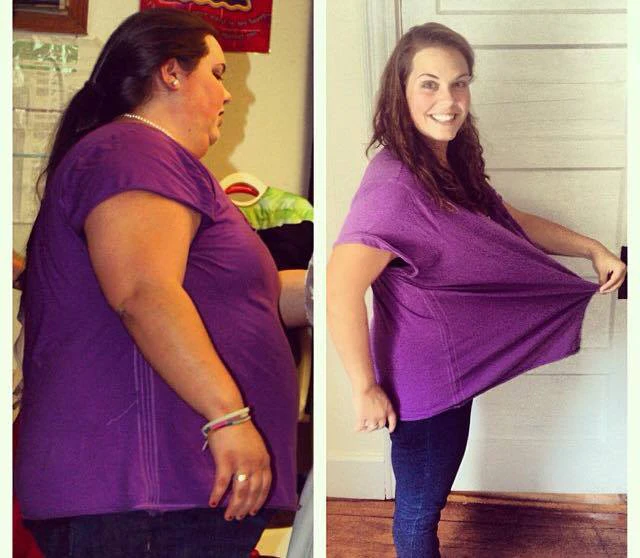 Woman Who Lost 165 Pounds Reveals The Downsides Of Losing A Lot Of Weight woman-who-lost-165-pounds-reveals-the-downsides-of-losing-a-lot-of-weight