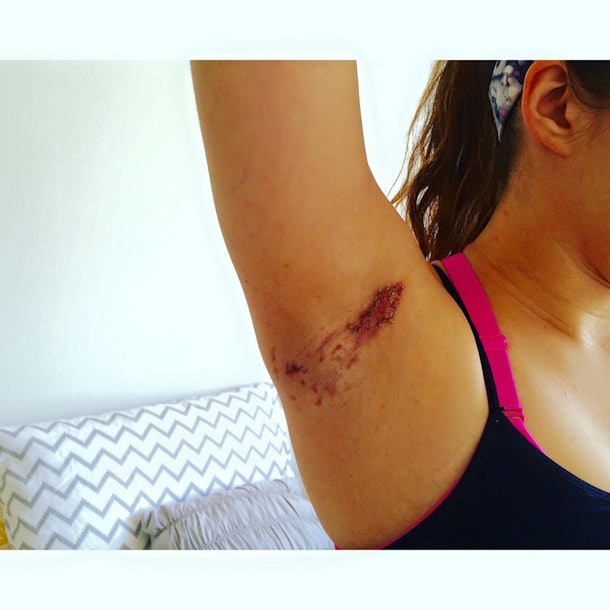 People Claim This Popular Deodorant Is Leaving The Most Insane Burns