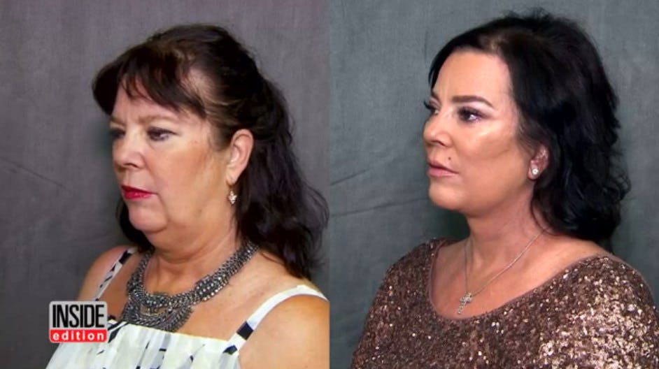 Kris Jenner's Sister Karen Houghton Got Plastic Surgery