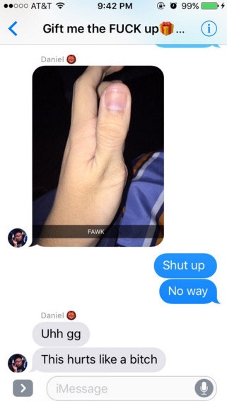 Scary Meme Claims To Show You How To Break Your Thumb
