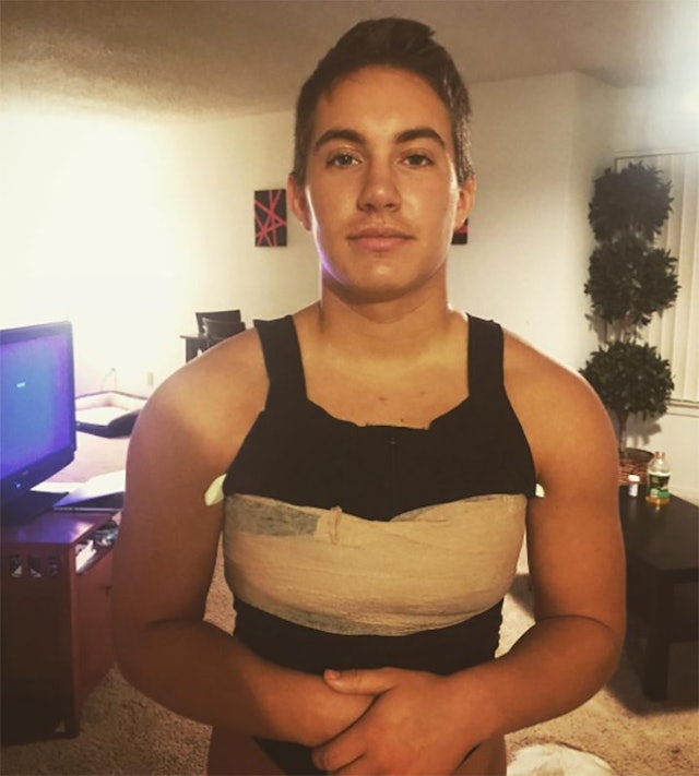 Trans Man's Before And After Photos Show Transition Process - 640 x 711 jpeg 60kB