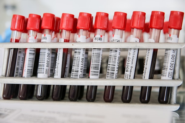 Here's how to help hospitals duing the coronavirus outbreak, by donating blood or money for supplies.