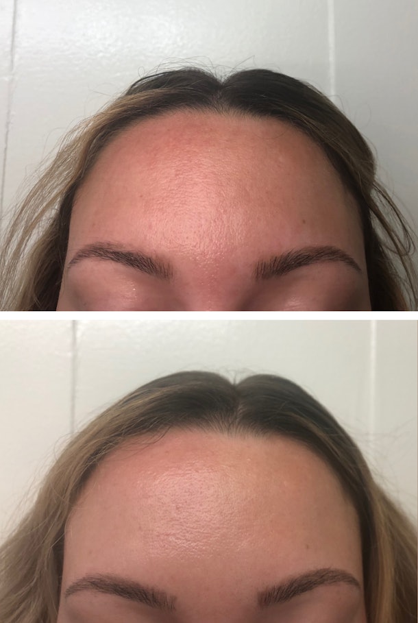 I Tried The Clear Brilliant Treatment For More Balanced Even Skin Couldn T Be Happier With The Results