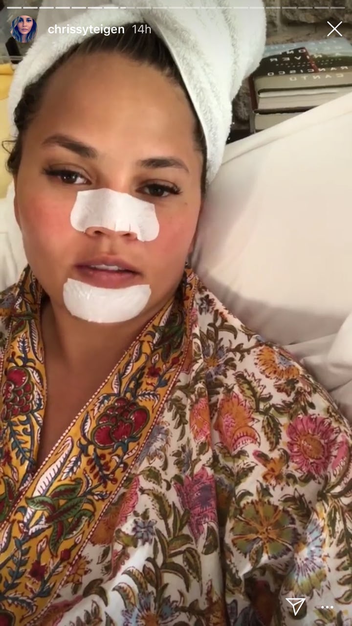 Chrissy Teigen S Instagram Story About Using Pore Strips Is Her Most Relatable Moment