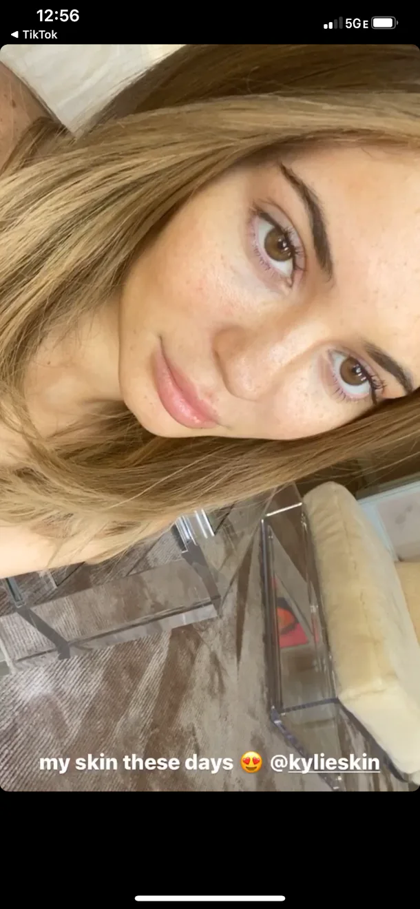 Kylie Jenner S Photos Without Makeup Showcase All Her Natural Freckles